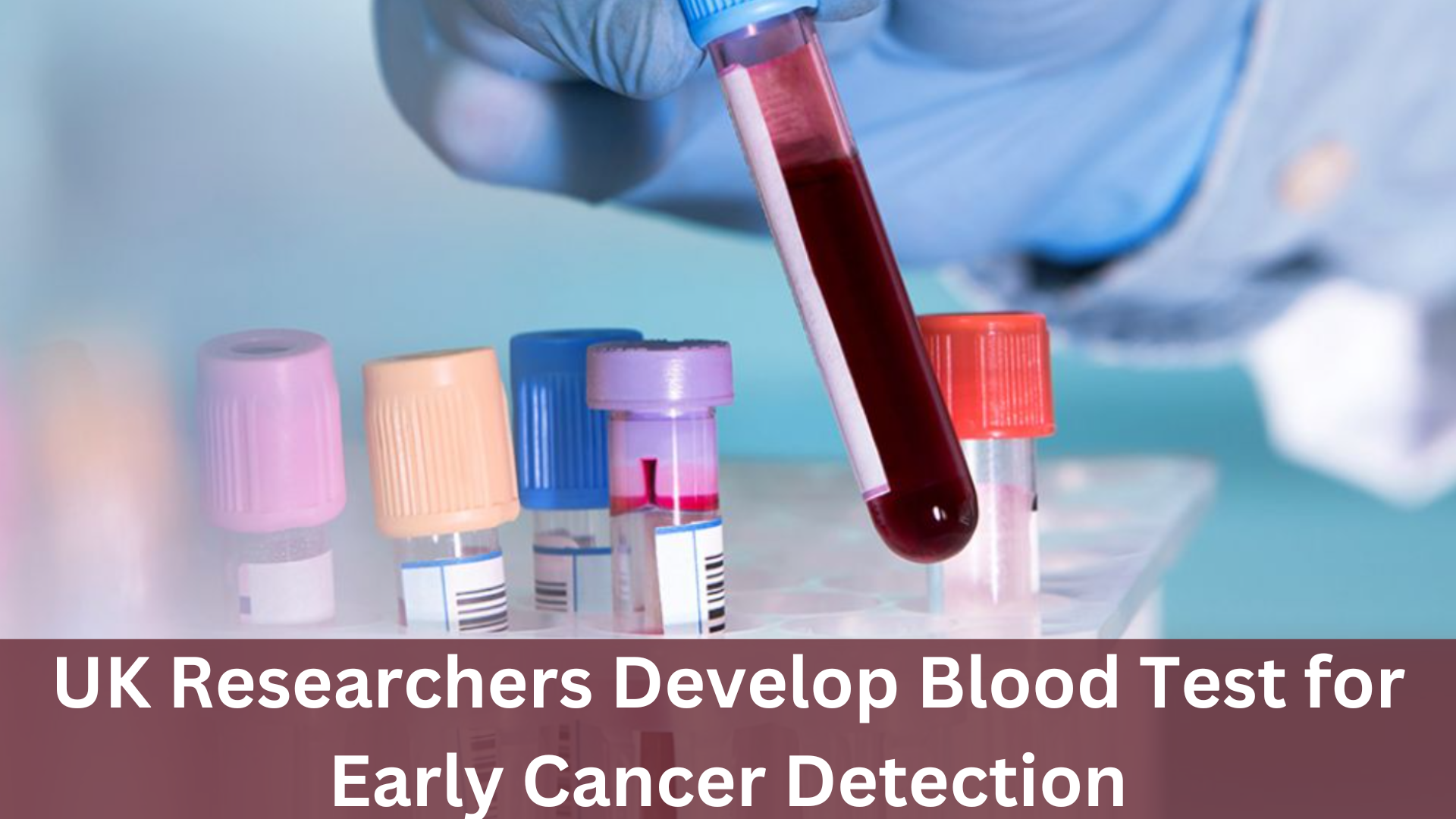 UK Researchers Develop Blood Test for Early Cancer Detection